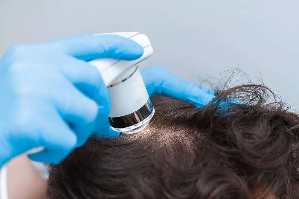 Hair Restoration in Portland
