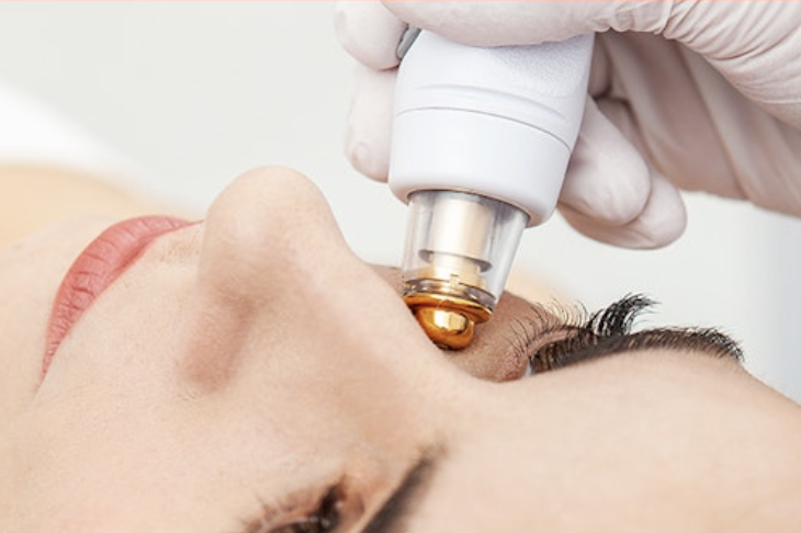 Radiofrequency in Portland