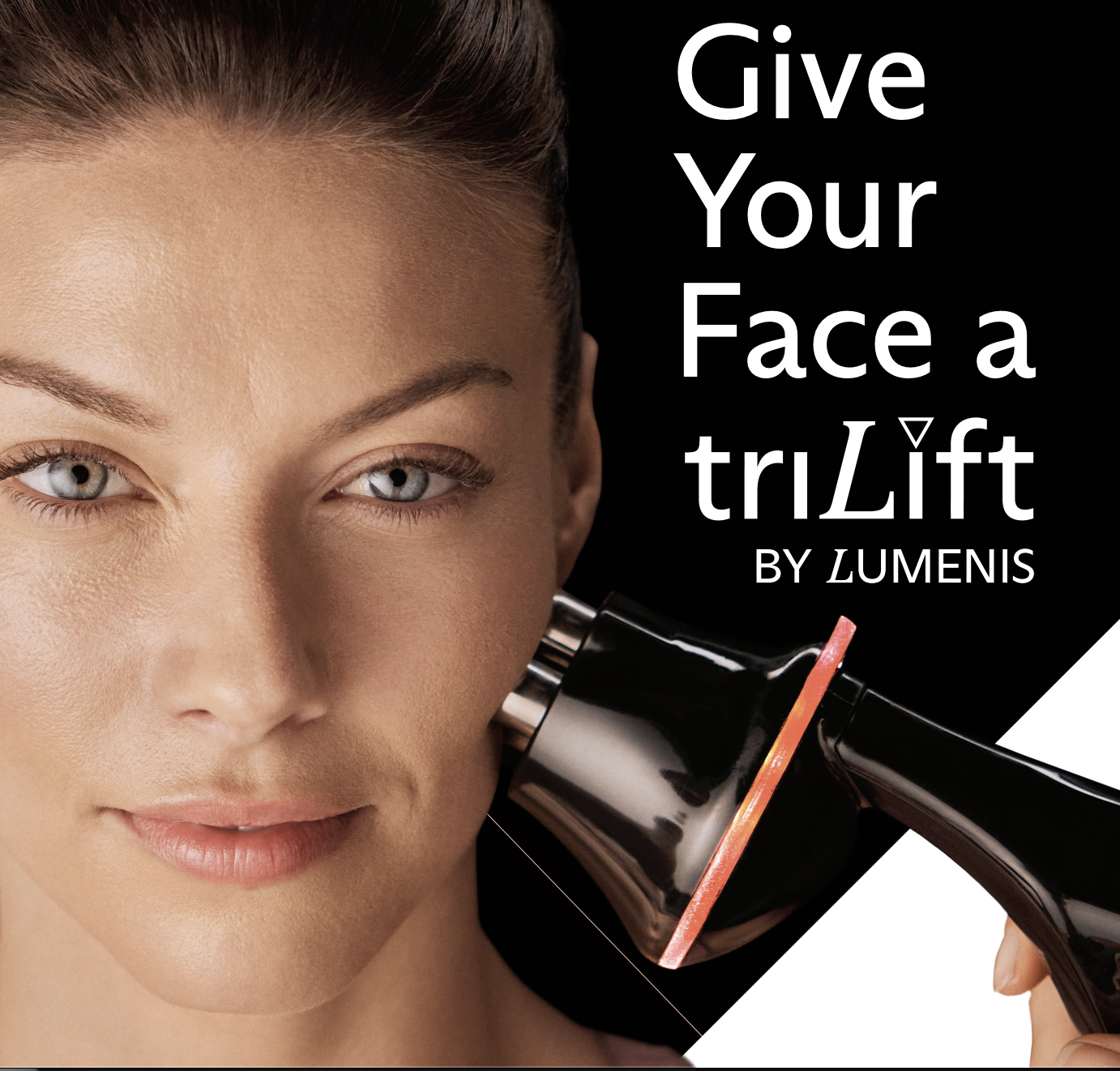 TriLift Dynamic Muscle Stimulation + RF + Microneedling in Portland